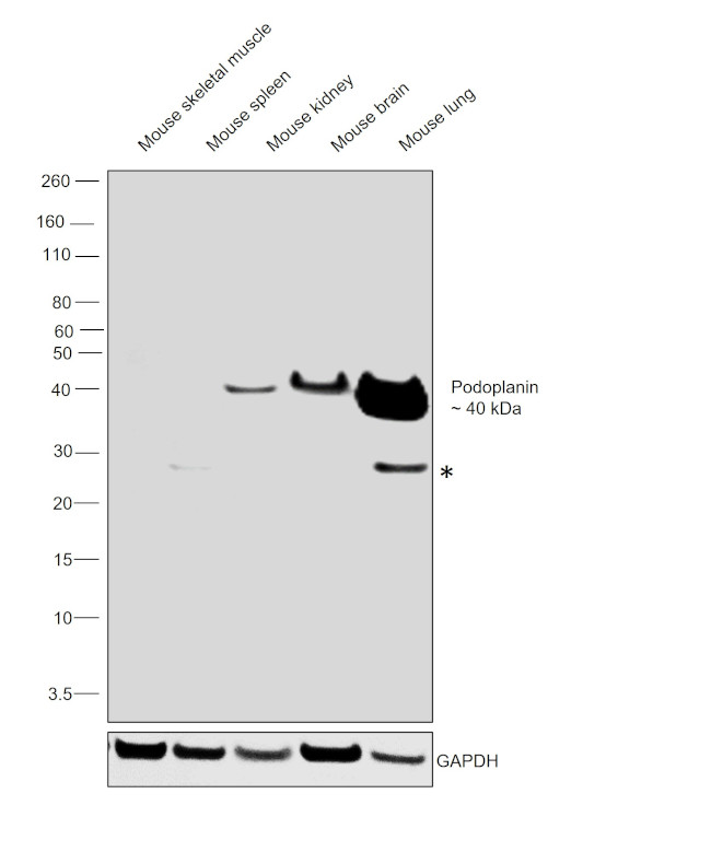 Podoplanin Antibody in Western Blot (WB)