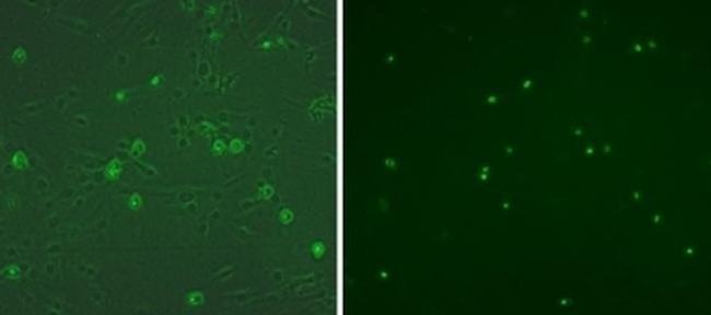 Myogenin Antibody in Immunocytochemistry (ICC/IF)