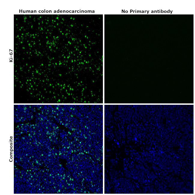 Ki-67 Antibody in Immunohistochemistry (Paraffin) (IHC (P))