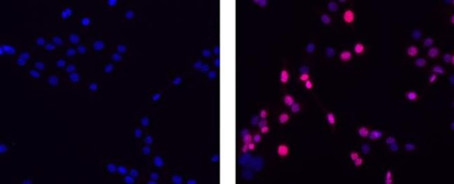 Ki-67 Antibody in Immunocytochemistry (ICC/IF)