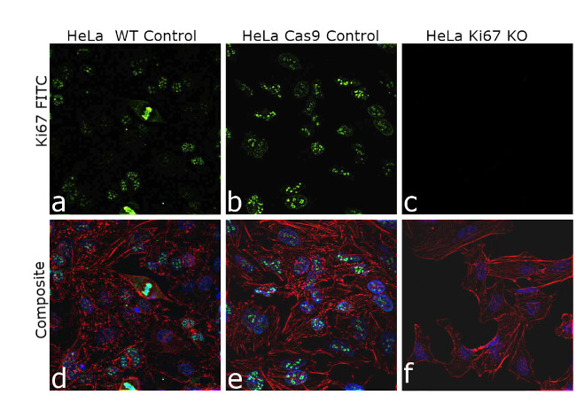 Ki-67 Antibody