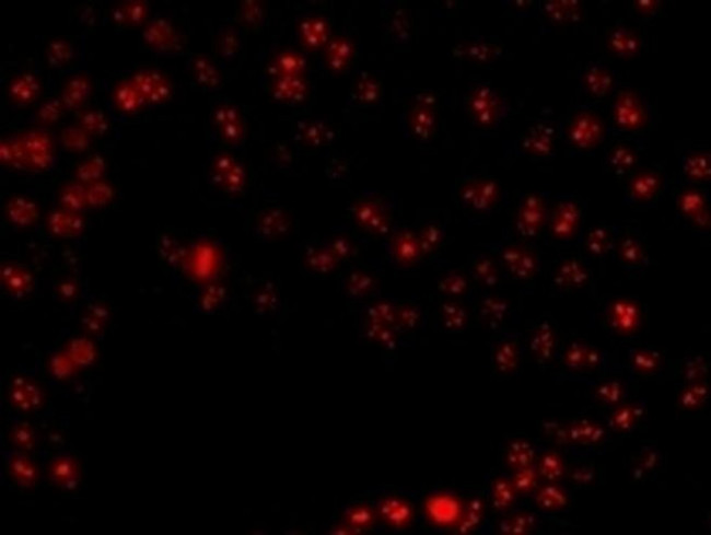 Ki-67 Antibody in Immunocytochemistry (ICC/IF)