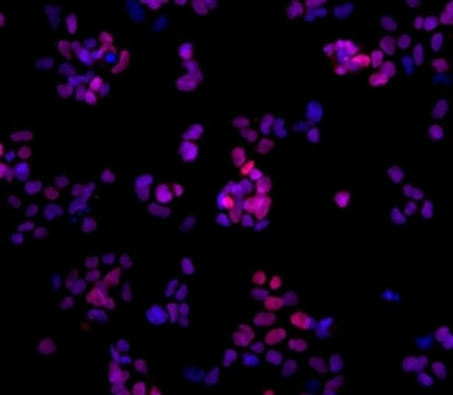 Nanog Antibody in Immunocytochemistry (ICC/IF)