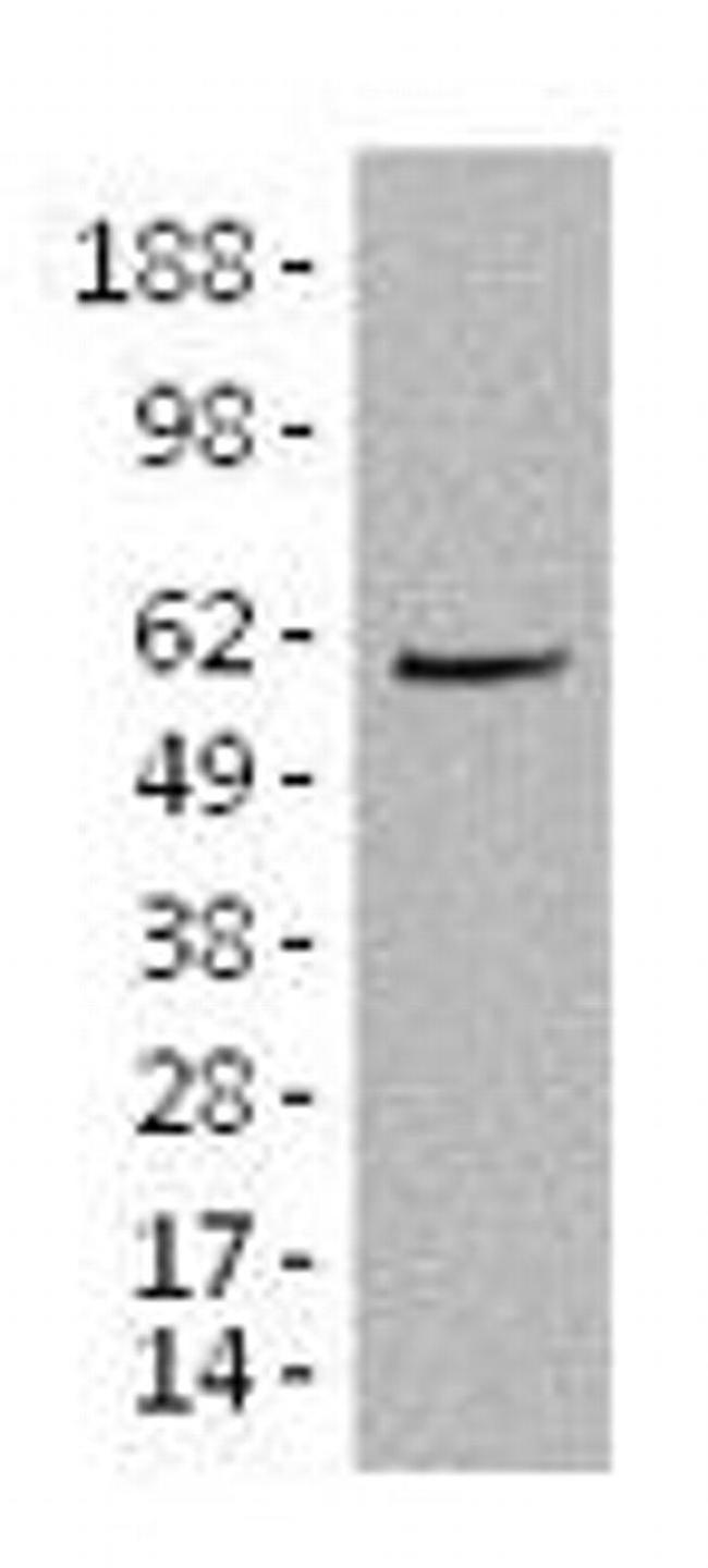 Aiolos Antibody in Western Blot (WB)