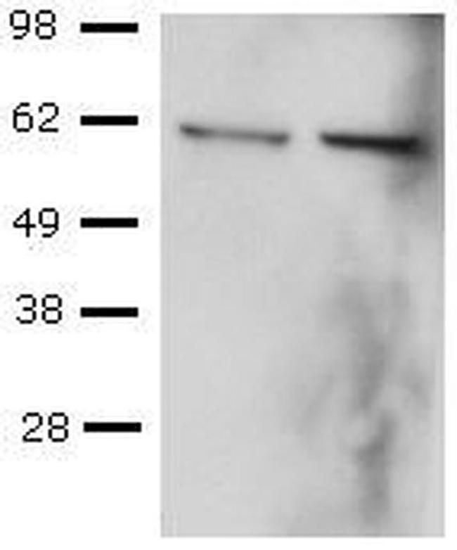 T-bet Antibody in Western Blot (WB)