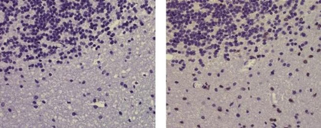 SOX10 Antibody in Immunohistochemistry (Paraffin) (IHC (P))