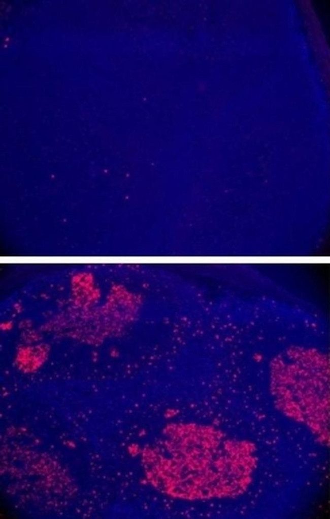 AID Antibody in Immunohistochemistry (IHC)