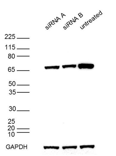 DDX5 Antibody