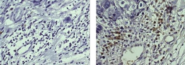 Trop2 (EGP-1) Antibody in Immunohistochemistry (Paraffin) (IHC (P))