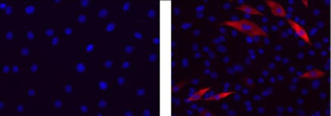 Myosin 4 Antibody in Immunocytochemistry (ICC/IF)