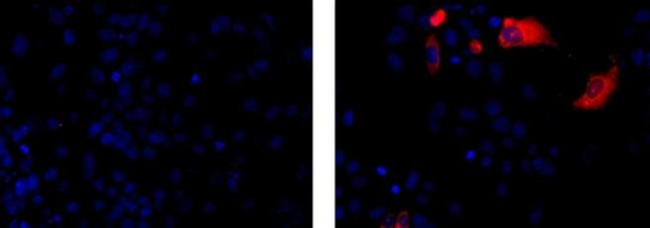 Chorionic Gonadotropin Antibody in Immunocytochemistry (ICC/IF)