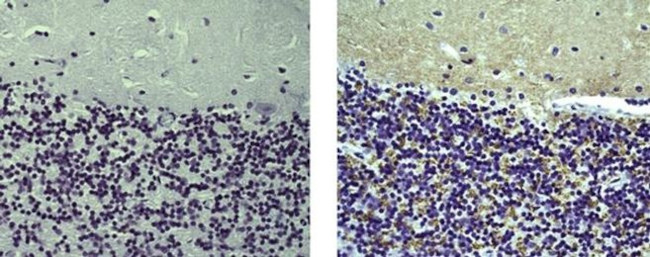 Synaptophysin Antibody in Immunohistochemistry (Paraffin) (IHC (P))