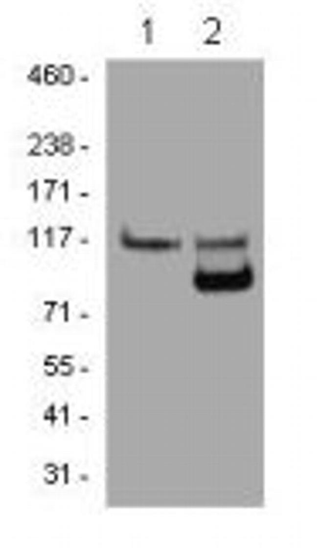 PARP1 Antibody in Western Blot (WB)