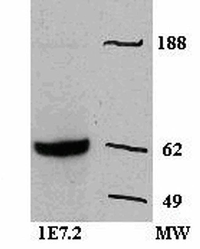 Zap-70 Antibody in Western Blot (WB)