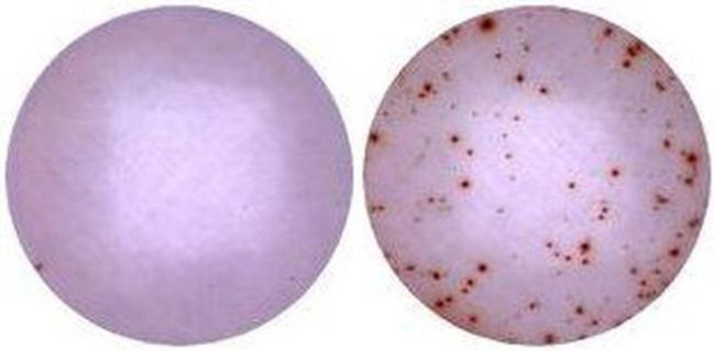 IFN gamma Antibody in Immunostaining (IS)