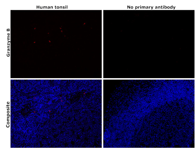 Granzyme B Antibody in Immunohistochemistry (Paraffin) (IHC (P))