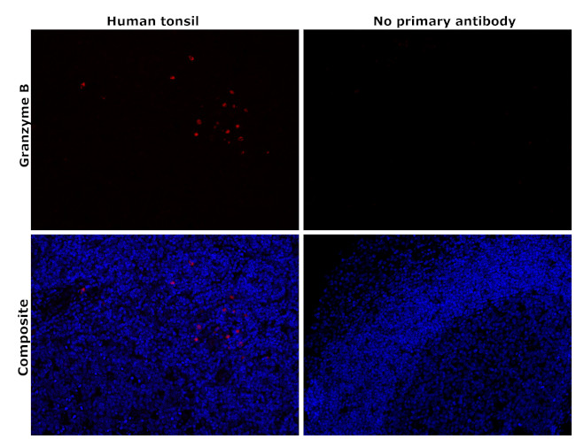 Granzyme B Antibody in Immunohistochemistry (Paraffin) (IHC (P))