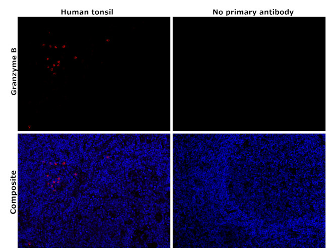 Granzyme B Antibody in Immunohistochemistry (Paraffin) (IHC (P))