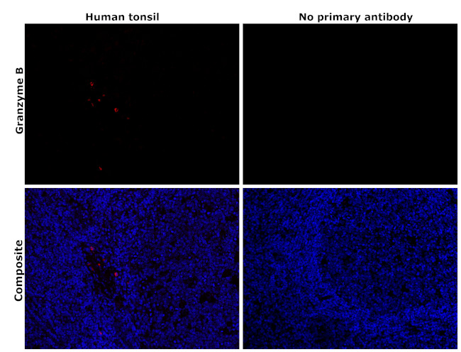 Granzyme B Antibody in Immunohistochemistry (Paraffin) (IHC (P))