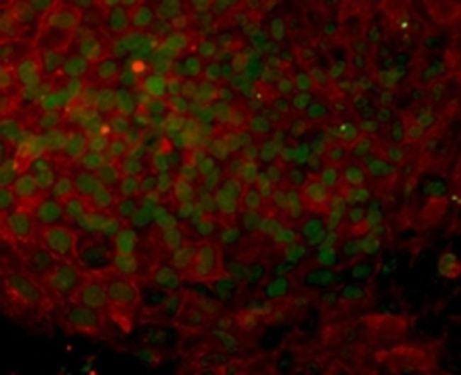 TRA-1-81 (Podocalyxin) Antibody in Immunocytochemistry (ICC/IF)