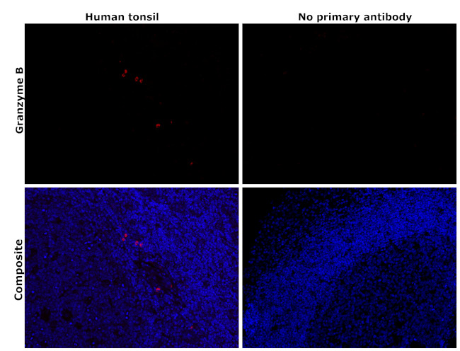 Granzyme B Antibody in Immunohistochemistry (Paraffin) (IHC (P))