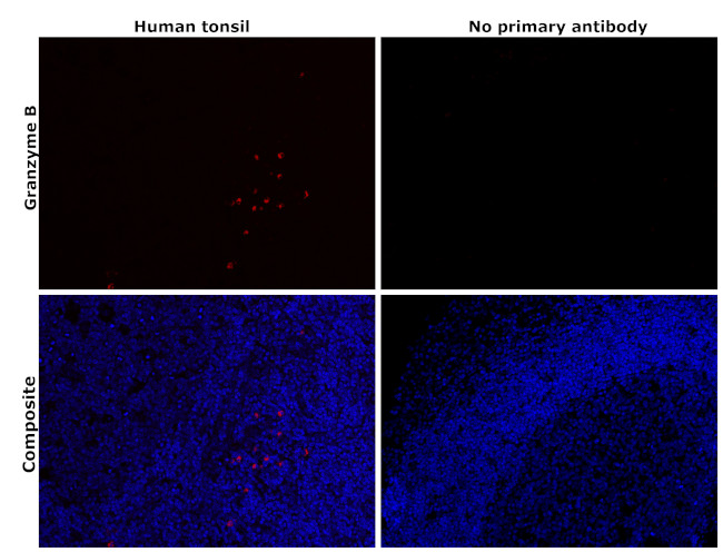 Granzyme B Antibody in Immunohistochemistry (Paraffin) (IHC (P))
