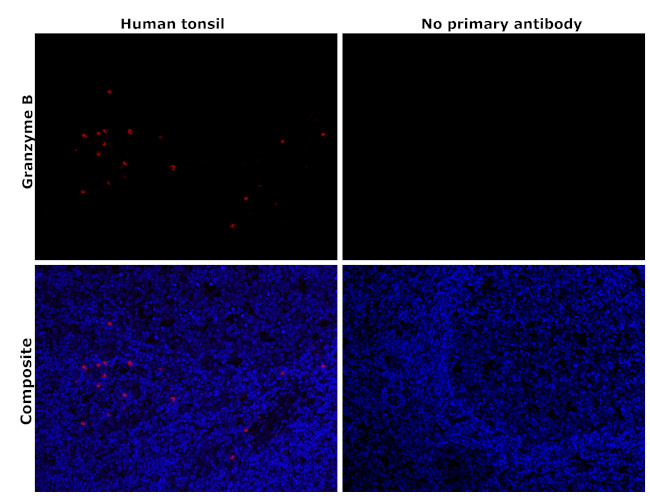 Granzyme B Antibody in Immunohistochemistry (Paraffin) (IHC (P))