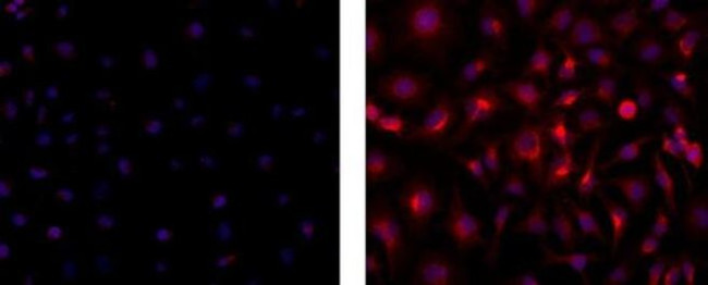 Cytokeratin 7 Antibody in Immunocytochemistry (ICC/IF)