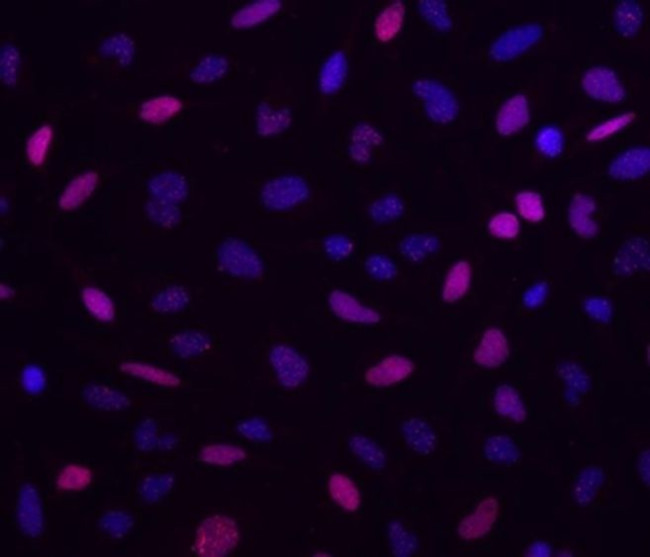 Phospho-ATM (Ser1981) Antibody in Immunocytochemistry (ICC/IF)