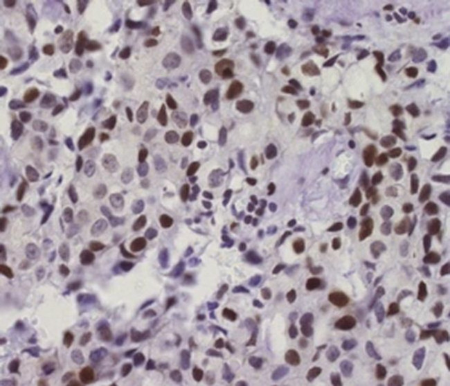 Phospho-ATM (Ser1981) Antibody in Immunohistochemistry (Paraffin) (IHC (P))