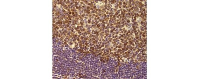 MCL-1 Antibody in Immunohistochemistry (Paraffin) (IHC (P))