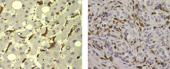 CD204 Antibody in Immunohistochemistry (Paraffin) (IHC (P))