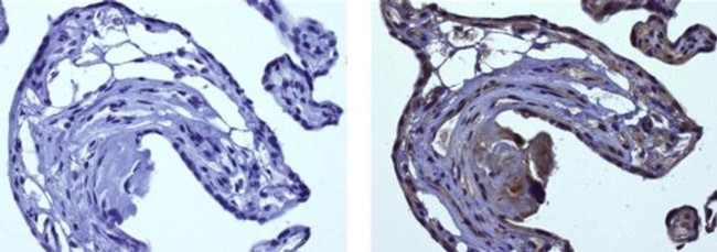 HIF-1 alpha Antibody in Immunohistochemistry (Paraffin) (IHC (P))