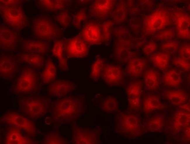 HSP27 Antibody in Immunocytochemistry (ICC/IF)