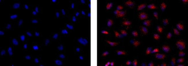 EEA1 Antibody in Immunocytochemistry (ICC/IF)