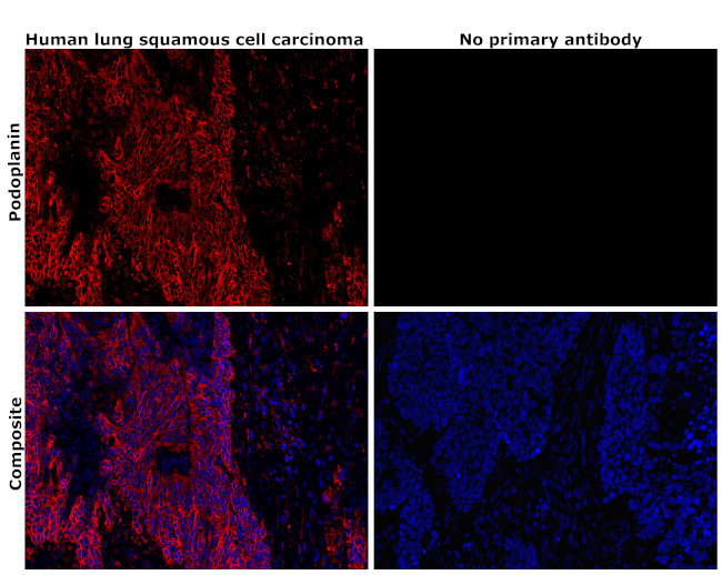 Podoplanin Antibody in Immunohistochemistry (Paraffin) (IHC (P))