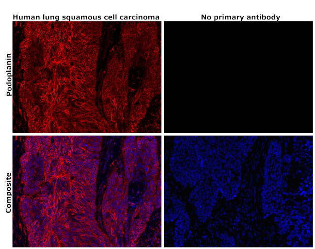 Podoplanin Antibody in Immunohistochemistry (Paraffin) (IHC (P))