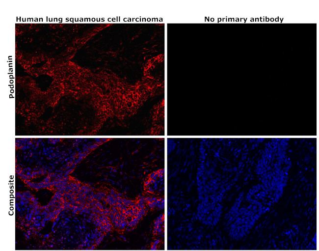 Podoplanin Antibody in Immunohistochemistry (Paraffin) (IHC (P))