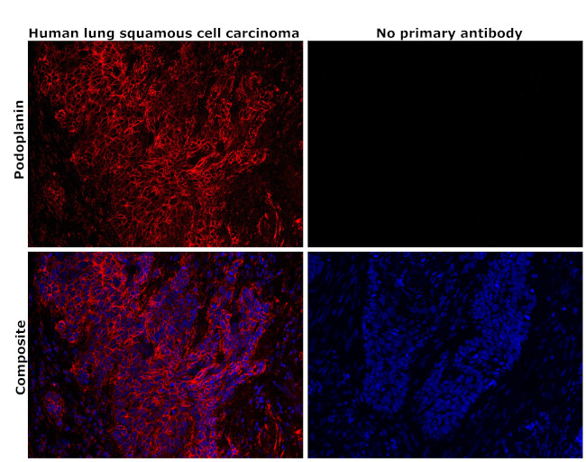 Podoplanin Antibody in Immunohistochemistry (Paraffin) (IHC (P))