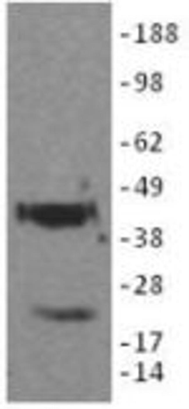 Podoplanin Antibody in Western Blot (WB)