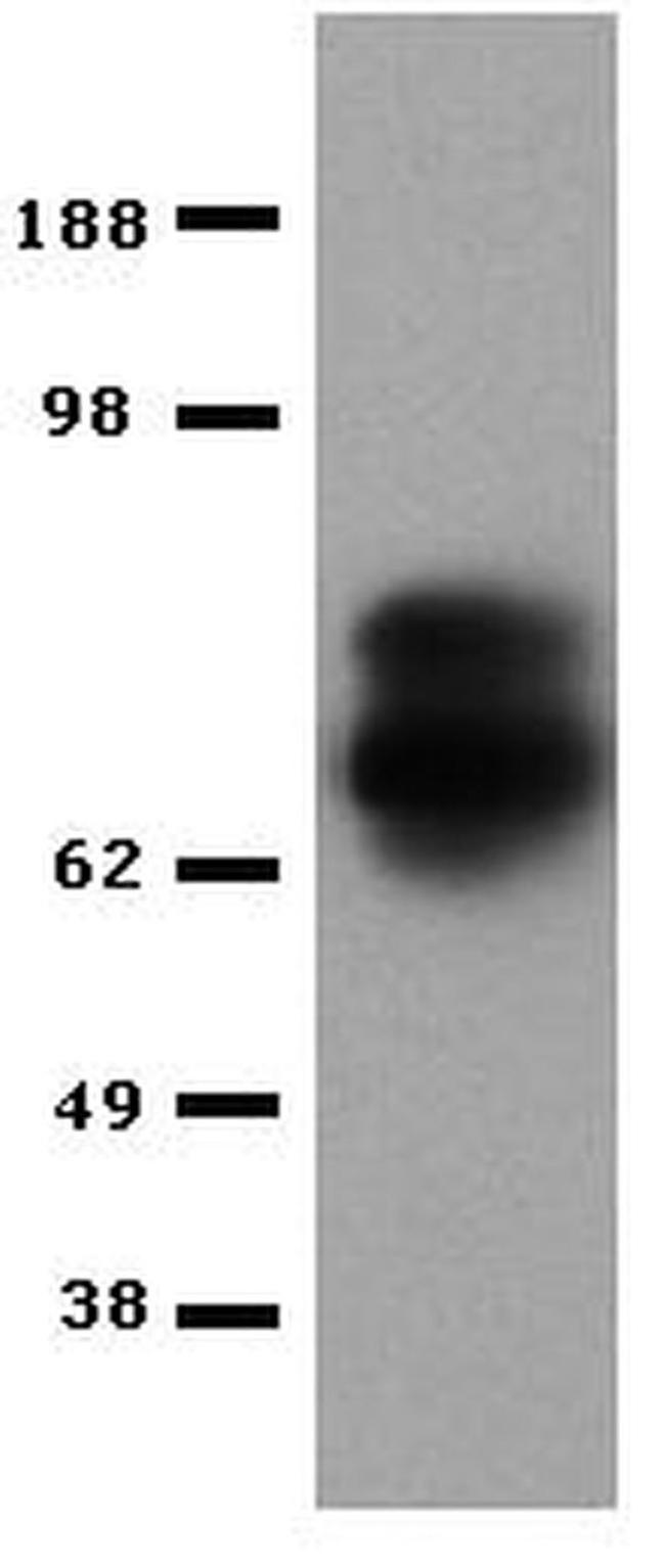 Perforin Antibody in Western Blot (WB)