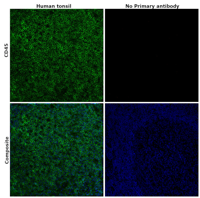 CD45 Antibody in Immunohistochemistry (Paraffin) (IHC (P))