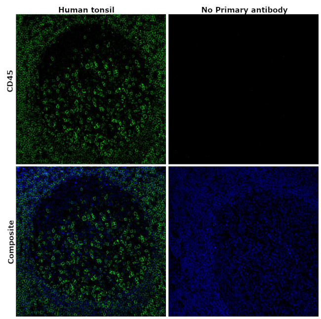 CD45 Antibody in Immunohistochemistry (Paraffin) (IHC (P))