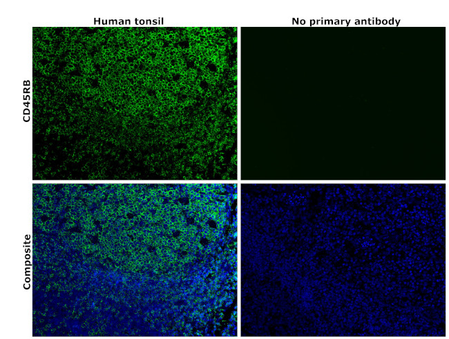 CD45RB Antibody in Immunohistochemistry (Paraffin) (IHC (P))