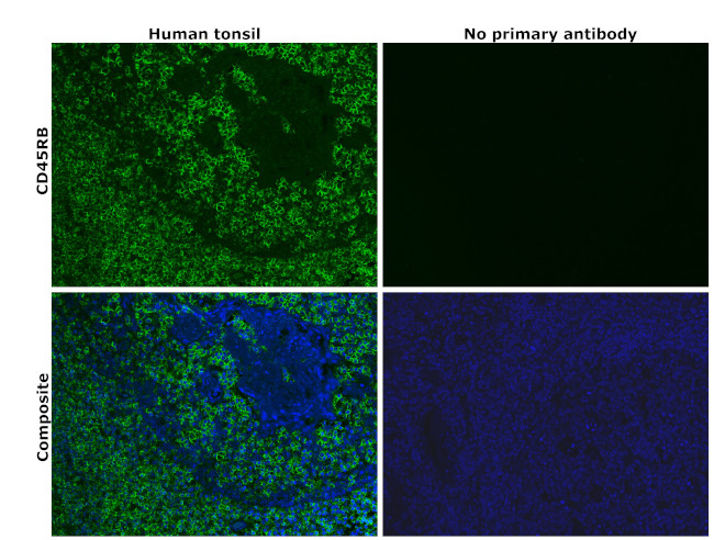 CD45RB Antibody in Immunohistochemistry (Paraffin) (IHC (P))