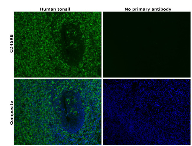 CD45RB Antibody in Immunohistochemistry (Paraffin) (IHC (P))