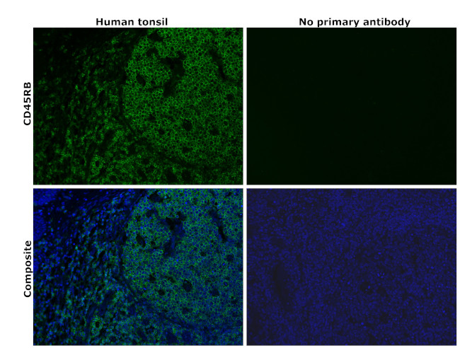 CD45RB Antibody in Immunohistochemistry (Paraffin) (IHC (P))