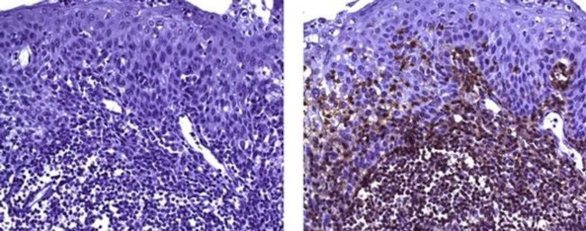 CD45RB Antibody in Immunohistochemistry (Paraffin) (IHC (P))