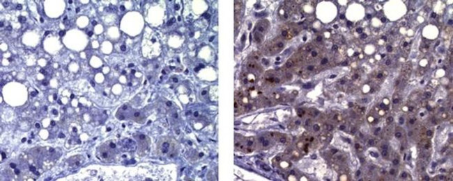 alpha-Fetoprotein Antibody in Immunohistochemistry (Paraffin) (IHC (P))