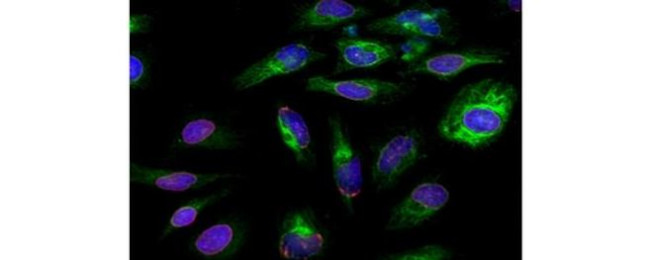 Lamin A/C Antibody in Immunocytochemistry (ICC/IF)